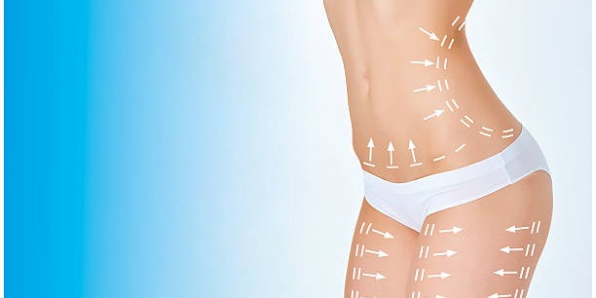 Liposuction Cost Insights for Patients Exploring Fat Removal