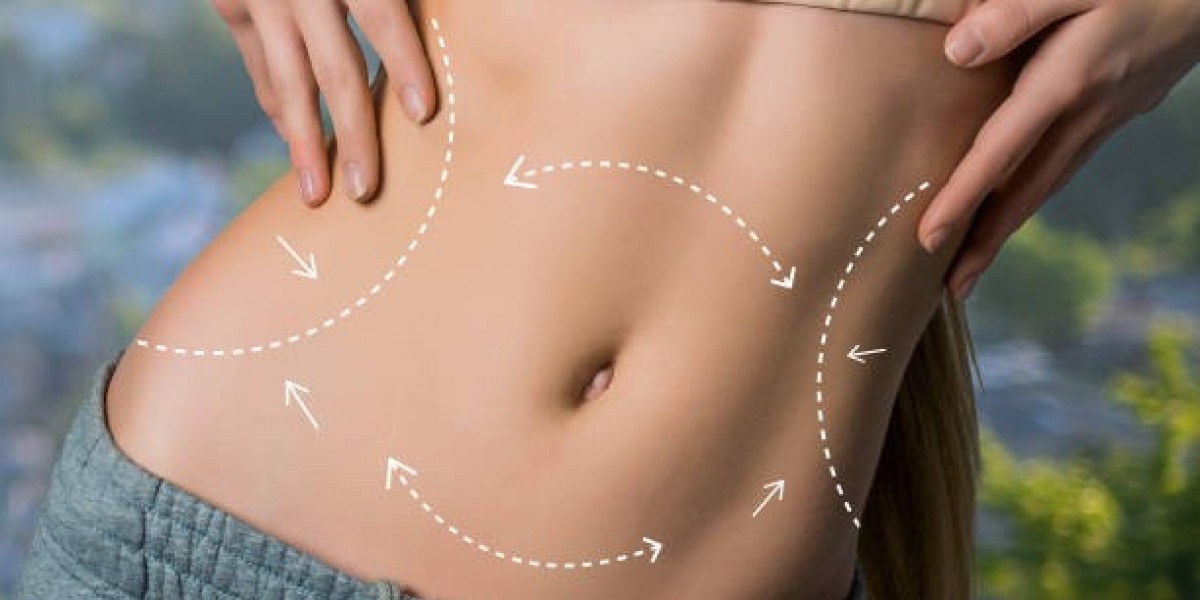Liposuction in Riyadh for Stubborn Abdominal Fat