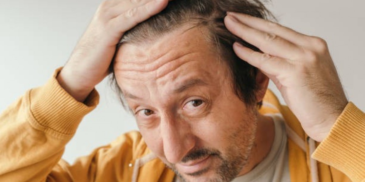 Hair Loss Treatment Aftercare: Essential Tips for Patients