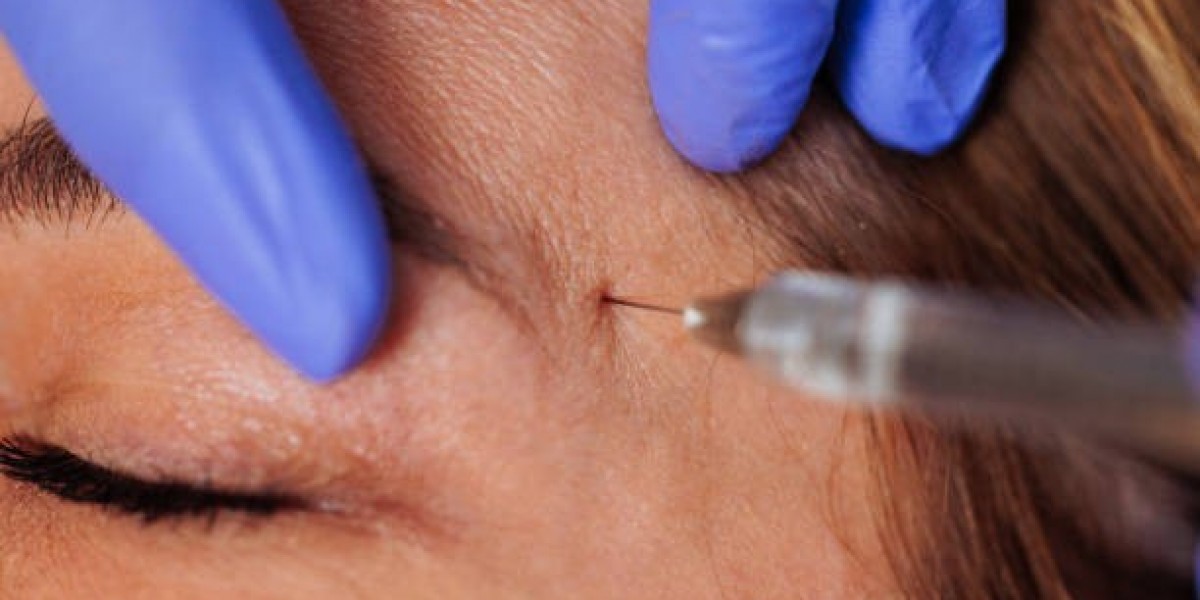 What Factors Affect Mole Removal Recovery?