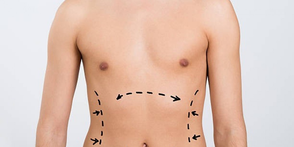 Liposuction Planning Tips for Better Body Contouring Outcomes