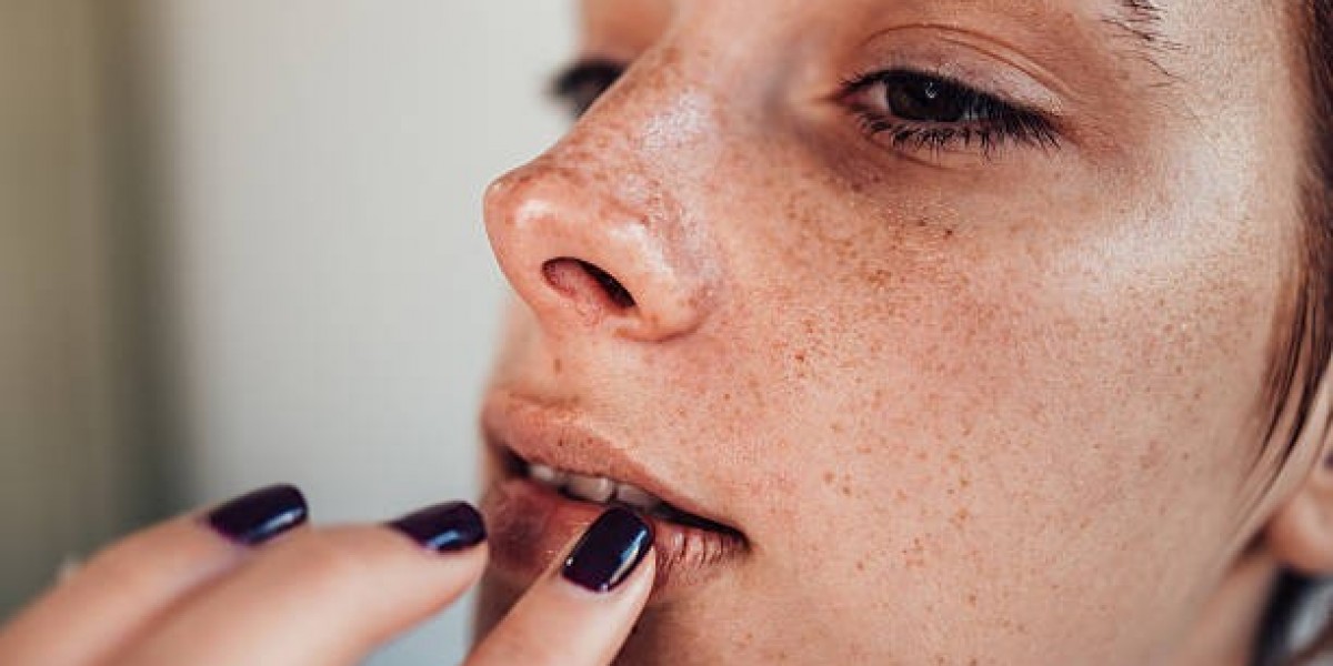 Dark Lips Treatment Packages in Riyadh: What to Check