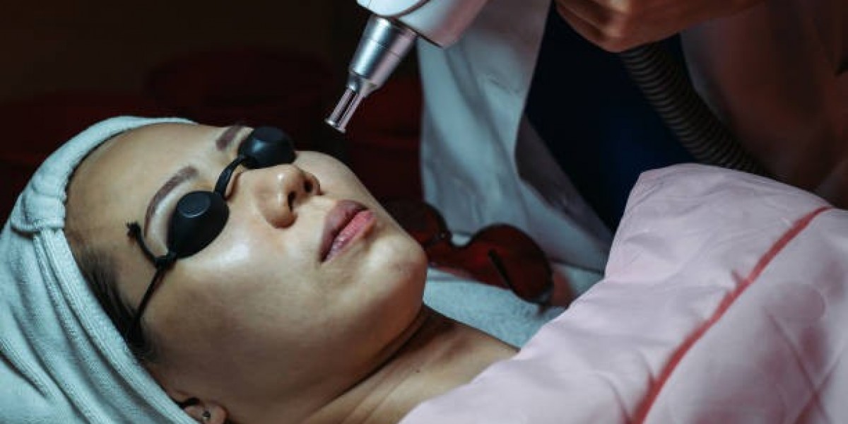 Can Q-Switched Laser Improve Uneven Skin Tone?