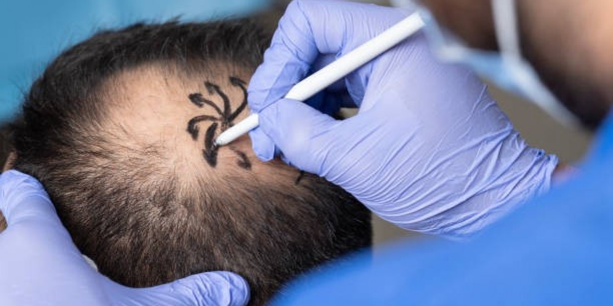 Riyadh’s Top Clinics for Hair Growth and Scalp Health