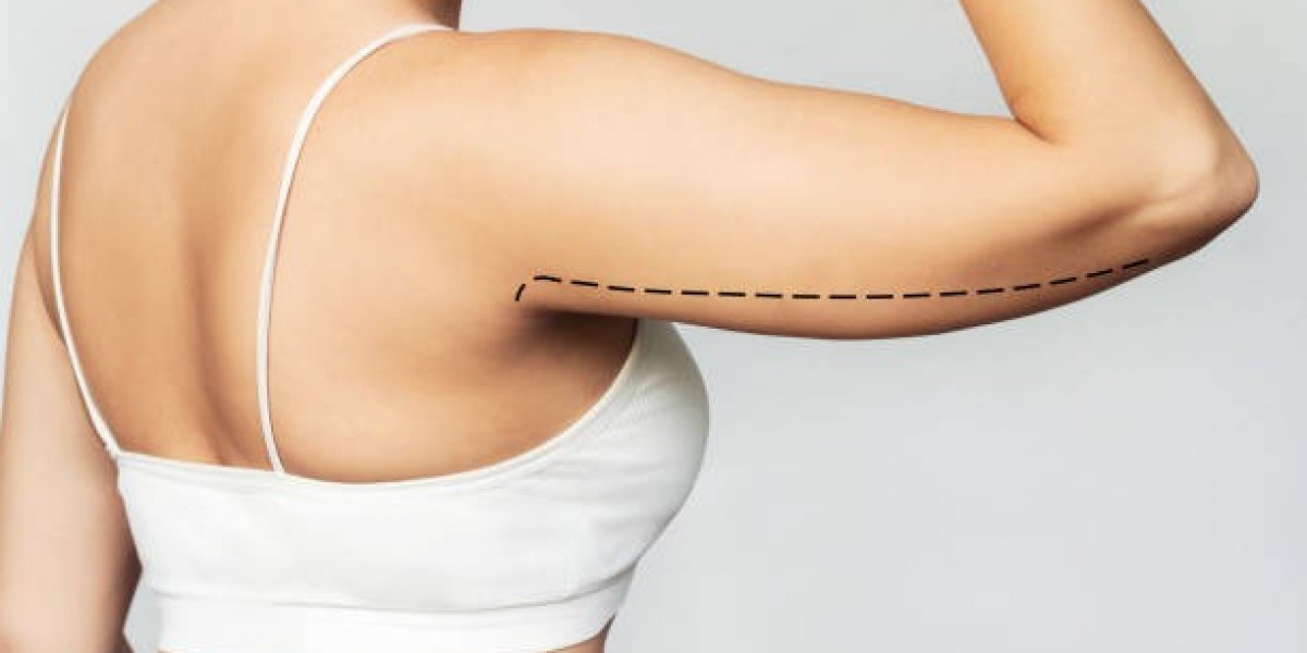 Liposuction in Riyadh: Exploring Personalized Fat Reduction Options